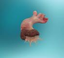 RestoreFlow Ascending Aorta & Valve