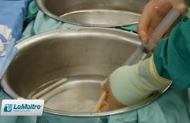 Artegraft Preparation