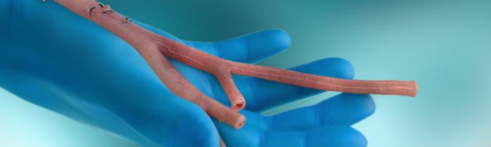 RestoreFlow Vascular