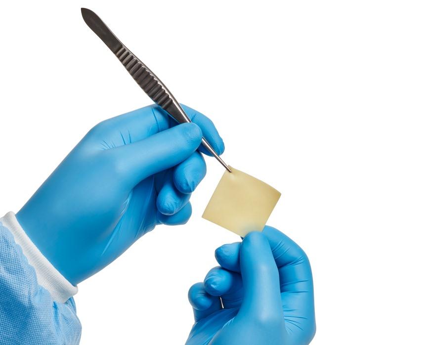Surgeon holding square XenoSure Patch