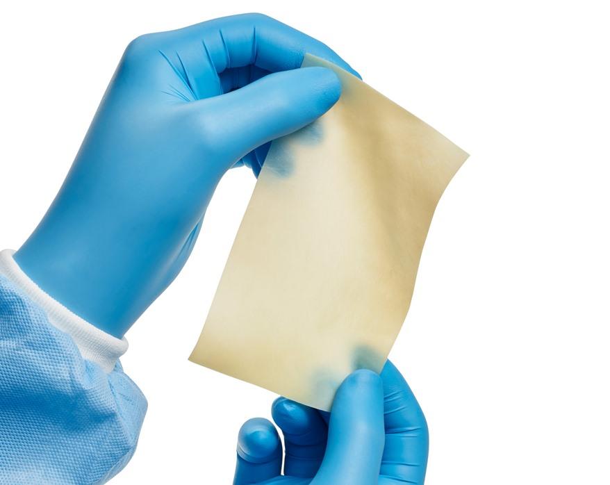 Surgeon holding Large XenoSure Patch