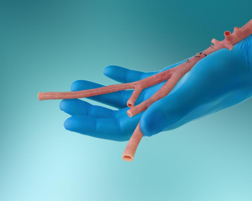 RestoreFlow Aortoiliac Allograft